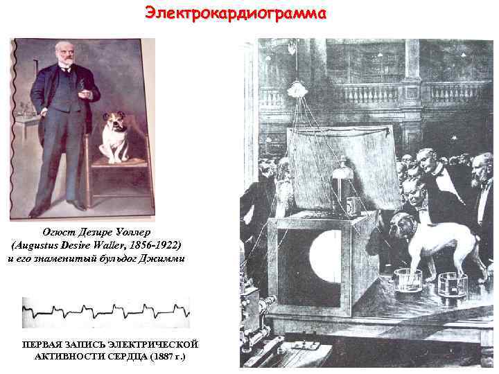 Электрокардиограмма Огюст Дезире Уоллер (Augustus Desire Waller, 1856 -1922) и его знаменитый бульдог Джимми