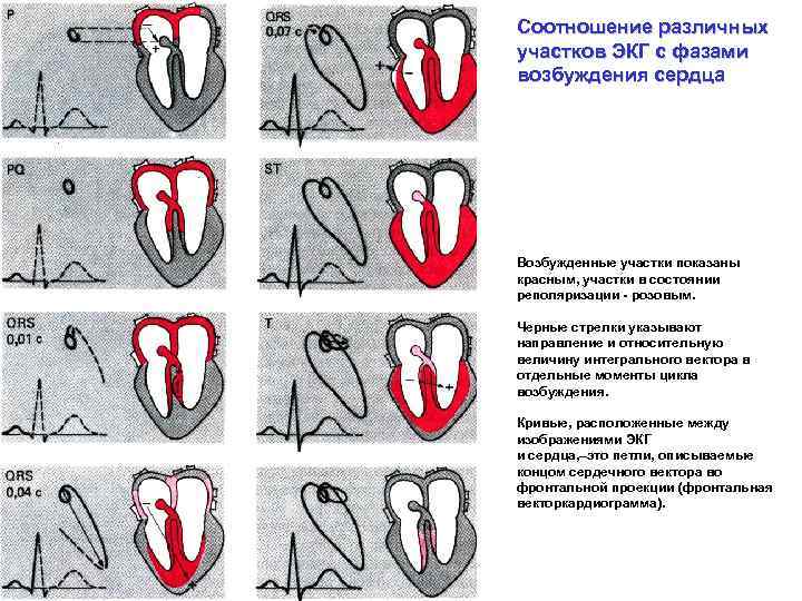 Соотношение различных участков ЭКГ с фазами возбуждения сердца Возбужденные участки показаны красным, участки в