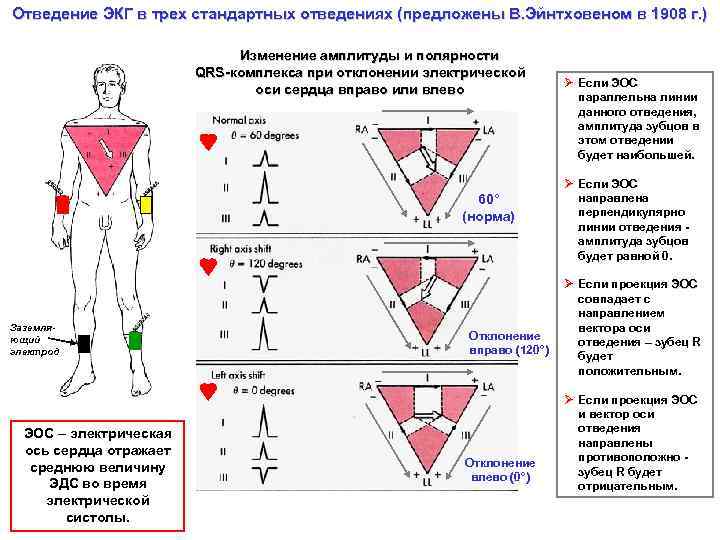 Отведение ЭКГ в трех стандартных отведениях (предложены В. Эйнтховеном в 1908 г. ) Изменение