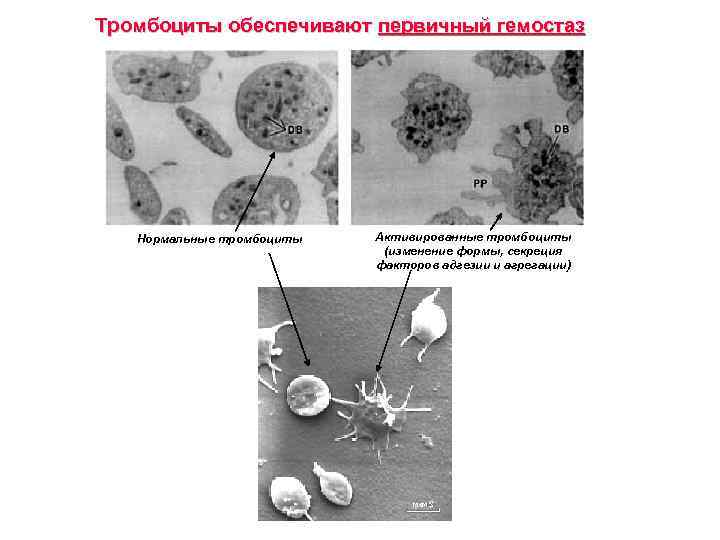 Тромбоциты обеспечивают первичный гемостаз Нормальные тромбоциты Активированные тромбоциты (изменение формы, секреция факторов адгезии и