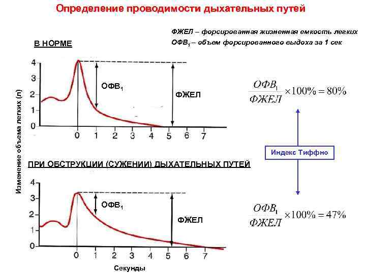 Определение проводимости дыхательных путей ФЖЕЛ – форсированная жизненная емкость легких ОФВ 1 – объем