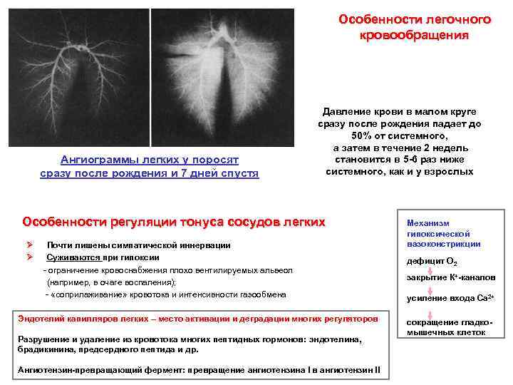 Особенности легочного кровообращения Ангиограммы легких у поросят сразу после рождения и 7 дней спустя