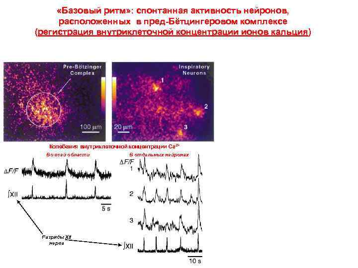  «Базовый ритм» : спонтанная активность нейронов, расположенных в пред-Бётцингеровом комплексе (регистрация внутриклеточной концентрации