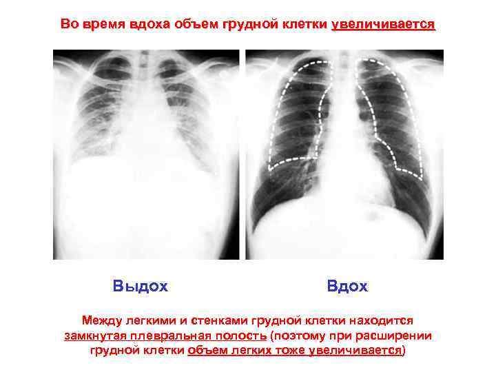 Во время вдоха объем грудной клетки увеличивается Выдох Вдох Между легкими и стенками грудной
