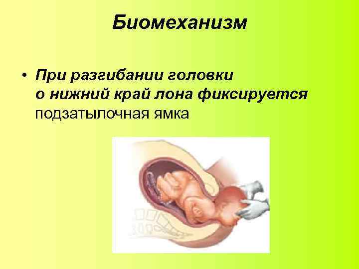 Биомеханизм • При разгибании головки о нижний край лона фиксируется подзатылочная ямка 