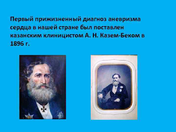 Первый прижизненный диагноз аневризма сердца в нашей стране был поставлен казанским клиницистом А. Н.