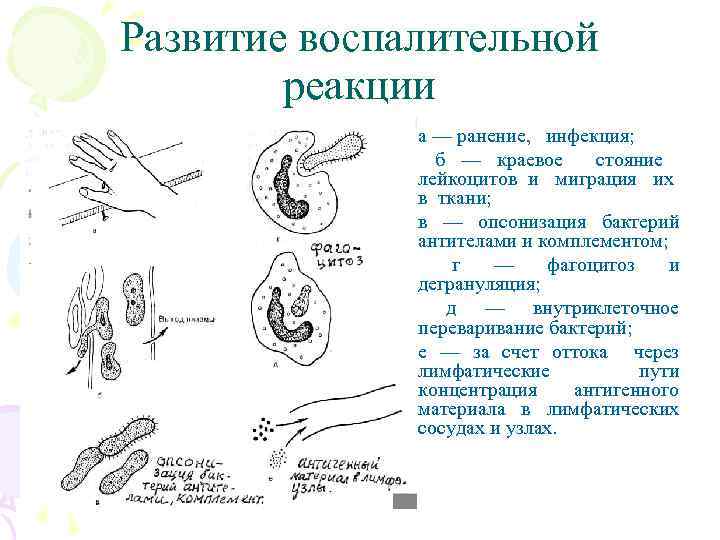 Развитие воспалительной реакции а — ранение, инфекция; б — краевое стояние лейкоцитов и миграция