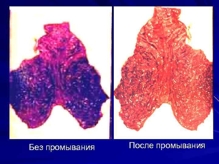 Без промывания После промывания 