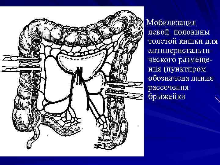 Брыжейка тонкой кишки где находится у человека фото