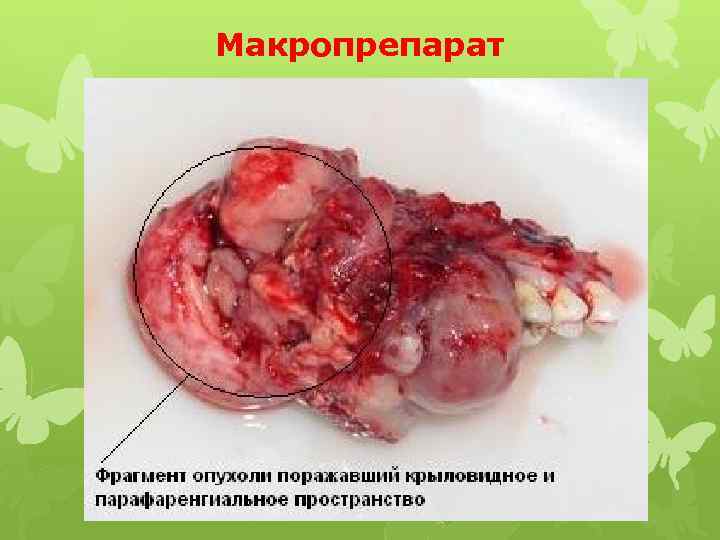 Макропрепарат 