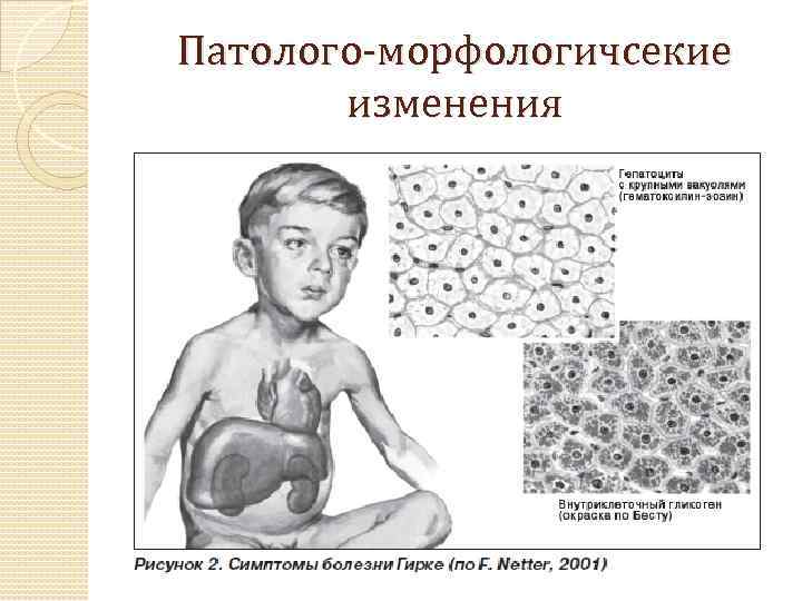 Патолого-морфологичсекие изменения 