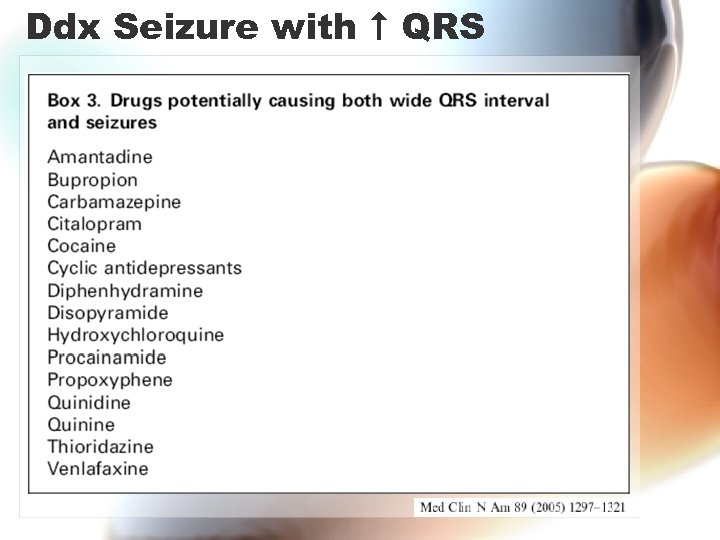 Ddx Seizure with QRS 