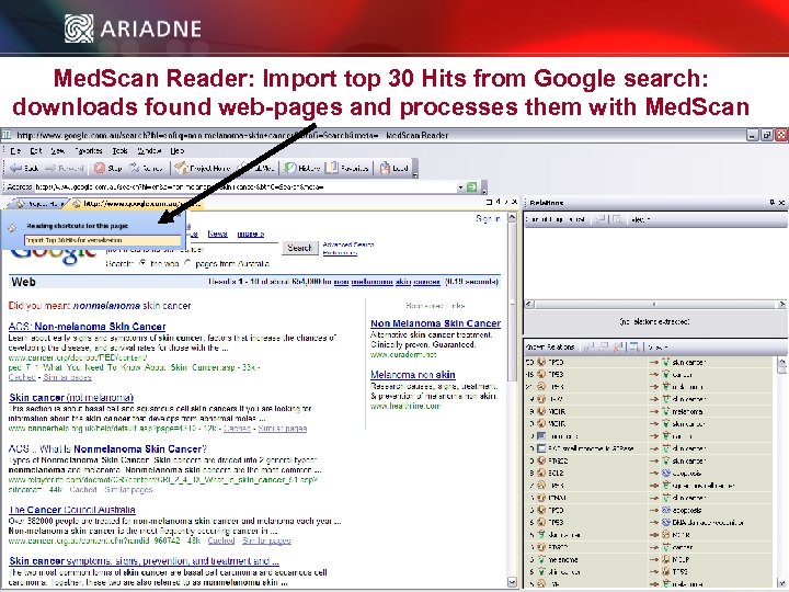 Med. Scan Reader: Import top 30 Hits from Google search: downloads found web-pages and