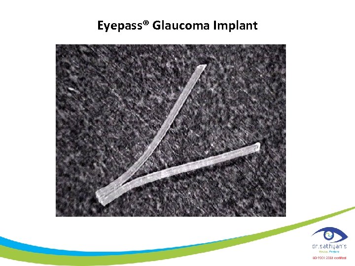 Eyepass® Glaucoma Implant 