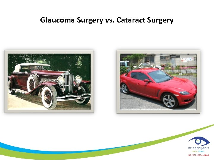 Glaucoma Surgery vs. Cataract Surgery 