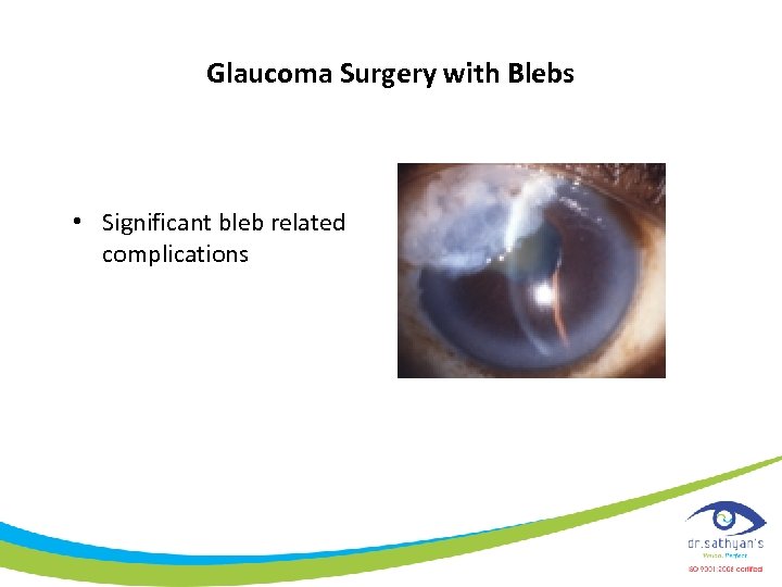 Glaucoma Surgery with Blebs • Significant bleb related complications 