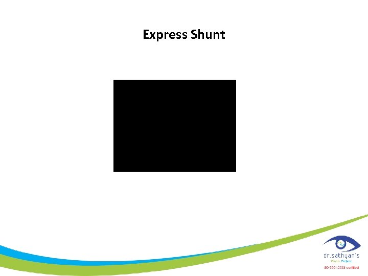 Express Shunt 