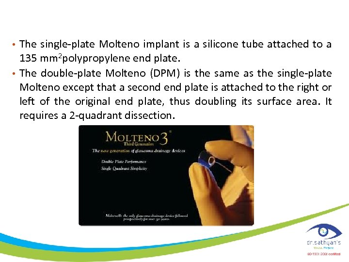  • The single-plate Molteno implant is a silicone tube attached to a 135