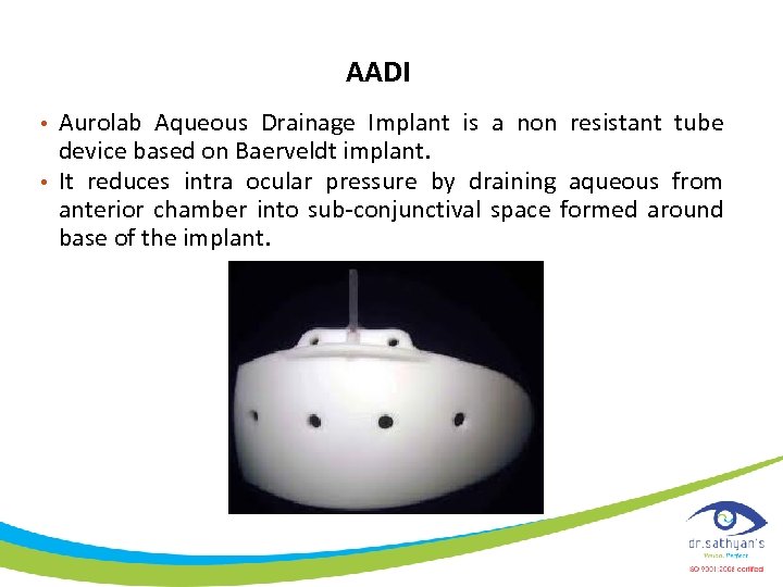AADI • Aurolab Aqueous Drainage Implant is a non resistant tube device based on