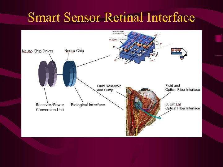 Smart Sensor Retinal Interface 