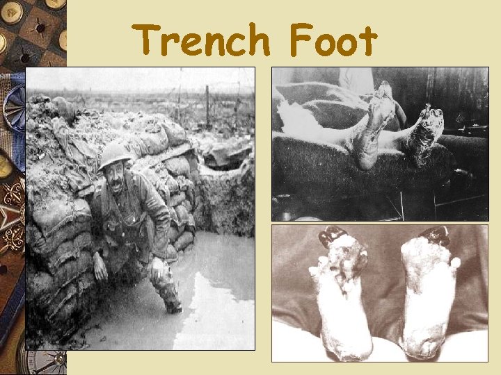 Trench Foot 