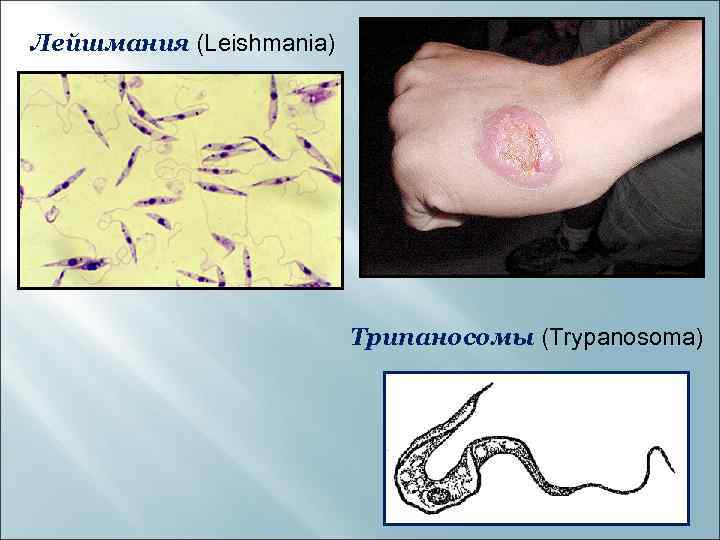 Лейшмания (Leishmania) Трипаносомы (Trypanosoma) 