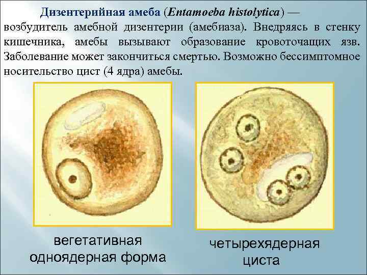 Амебиаз что это такое