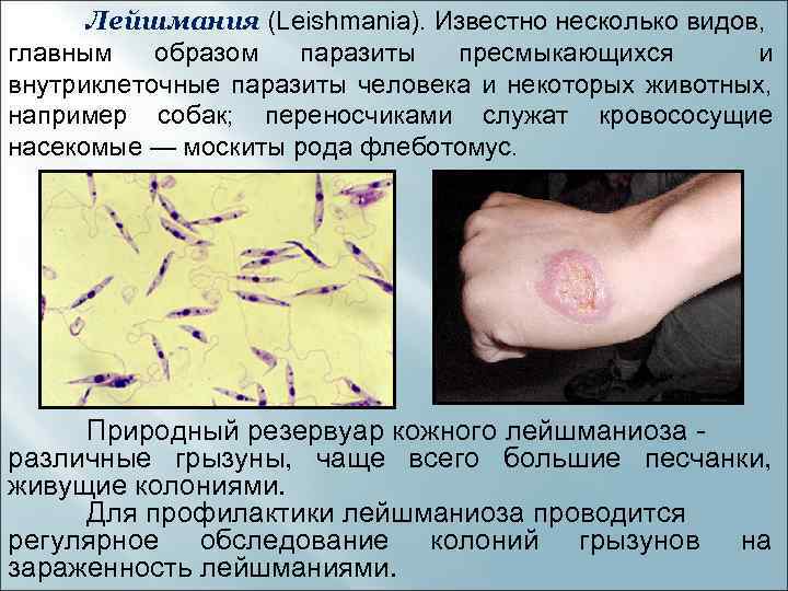 Лейшмания (Leishmania). Известно несколько видов, главным образом паразиты пресмыкающихся и внутриклеточные паразиты человека и