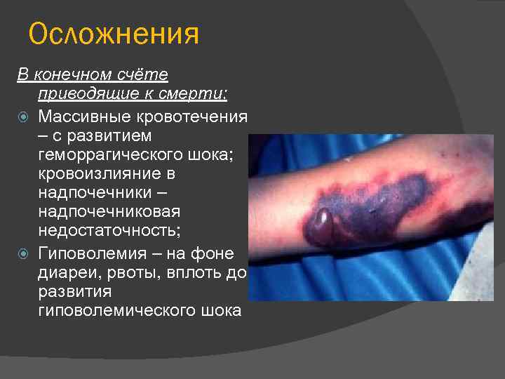 Осложнения В конечном счёте приводящие к смерти: Массивные кровотечения – с развитием геморрагического шока;