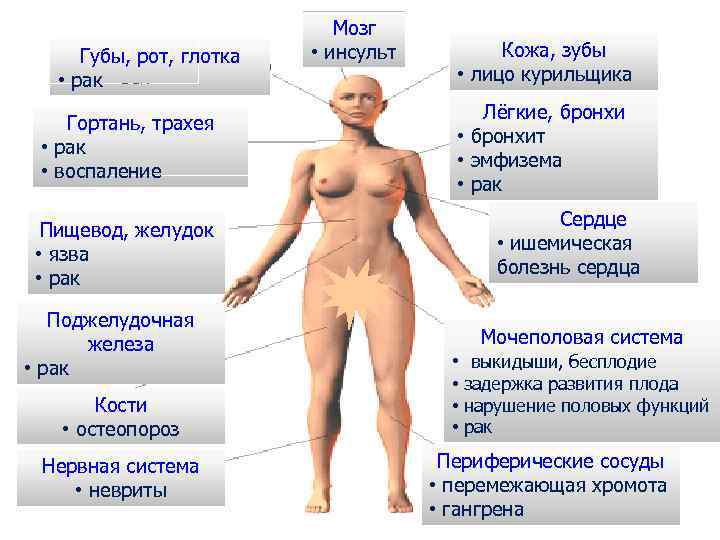 Губы, рот, глотка • рак Гортань, трахея • рак • воспаление Пищевод, желудок •