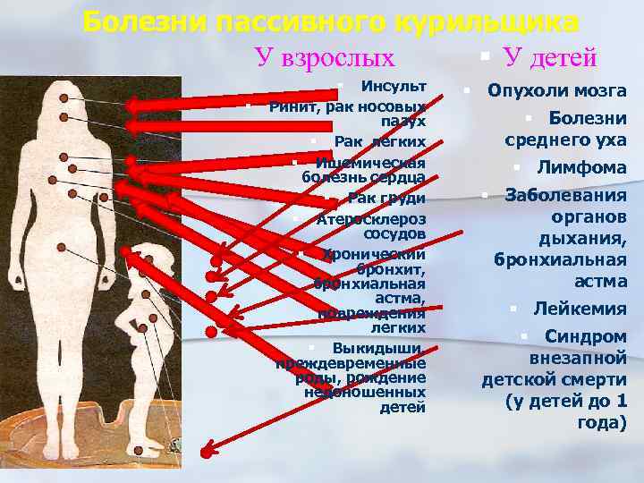 Болезни пассивного курильщика У взрослых У детей Инсульт Ринит, рак носовых пазух Рак легких