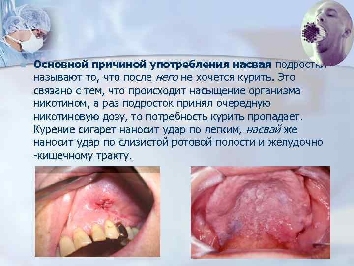 n Основной причиной употребления насвая подростки называют то, что после него не хочется курить.