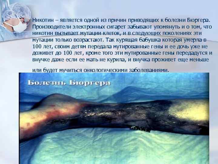 n Никотин – является одной из причин приводящих к болезни Бюргера. Производители электронных сигарет