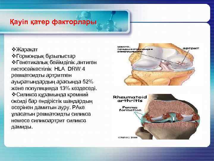 Қауіп қатер факторлары v. Жарақат v. Гормондық бұзылыстар v. Генетикалық бейімділік , антиген гистосәйкестілік