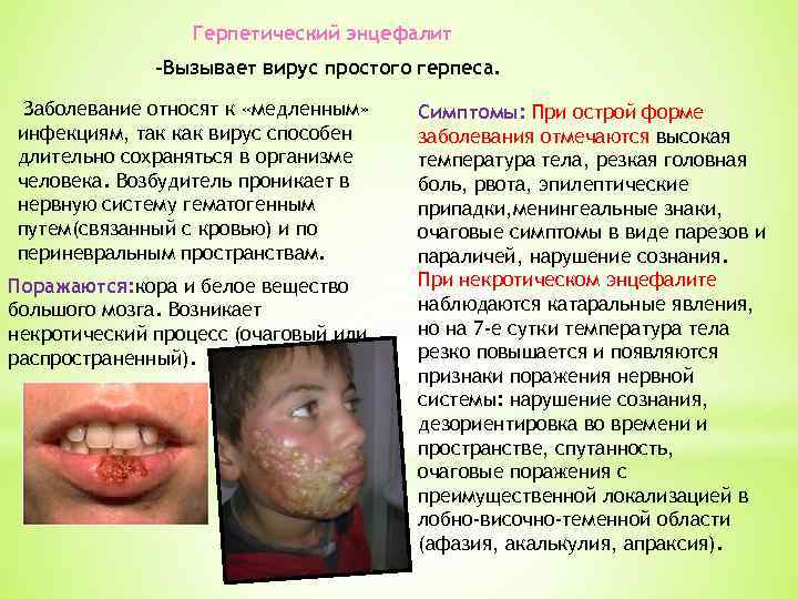 Герпетический энцефалит -Вызывает вирус простого герпеса. Заболевание относят к «медленным» инфекциям, так как вирус
