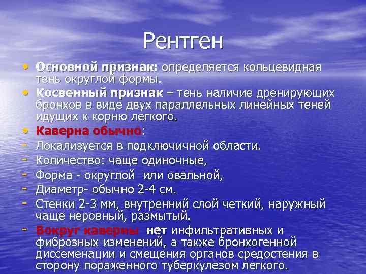 Рентген • Основной признак: определяется кольцевидная • • - тень округлой формы. Косвенный признак