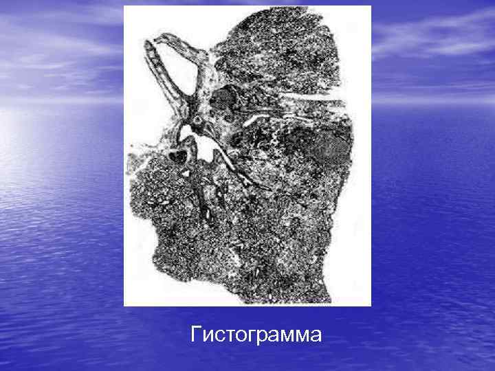 Гистограмма 