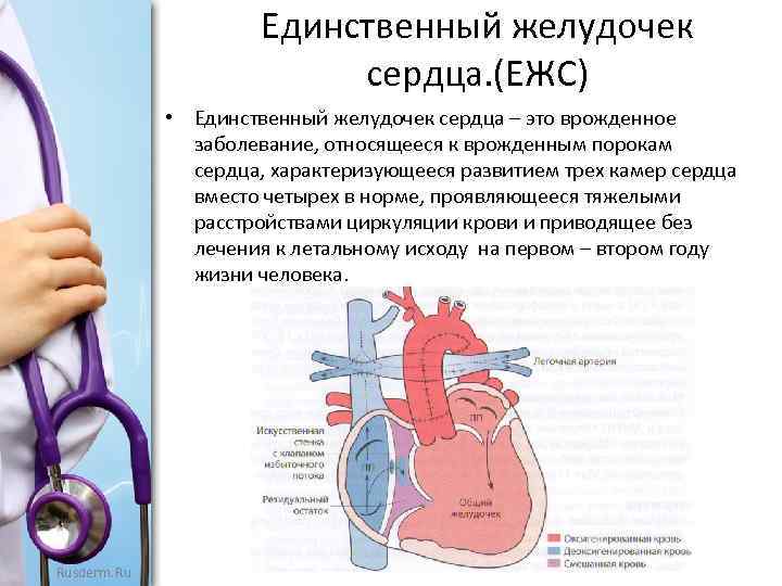 Операция фонтена на сердце схема