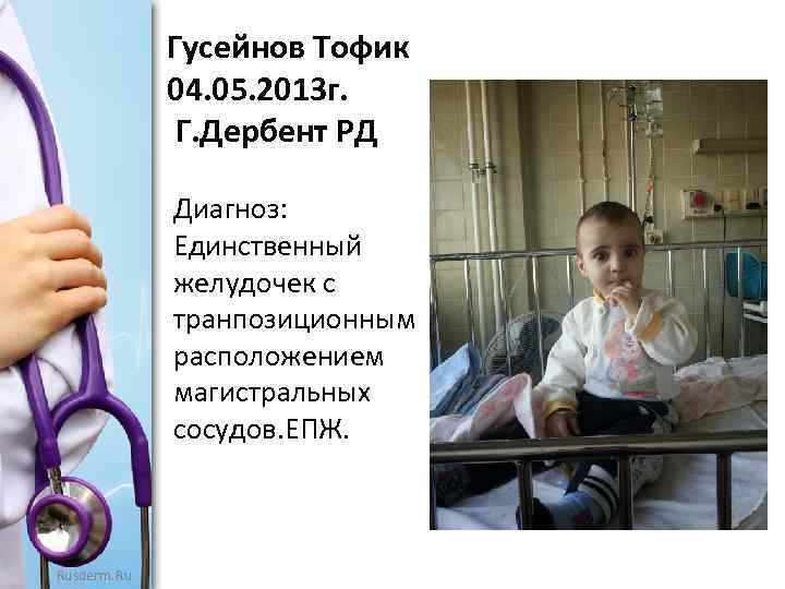 Гусейнов Тофик 04. 05. 2013 г. Г. Дербент РД Диагноз: Единственный желудочек с транпозиционным