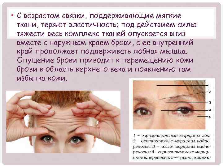  • С возрастом связки, поддерживающие мягкие ткани, теряют эластичность; под действием силы тяжести
