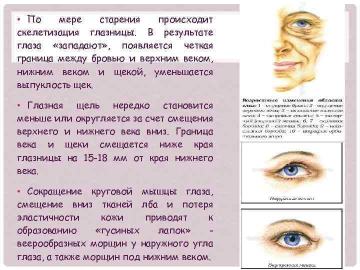  • По мере старения происходит скелетизация глазницы. В результате глаза «западают» , появляется