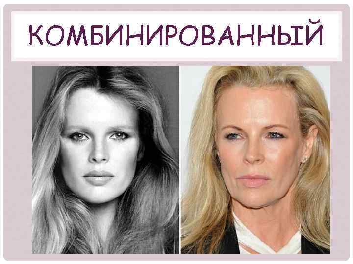 КОМБИНИРОВАННЫЙ 