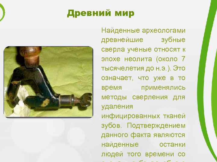 Древний мир Найденные археологами древнейшие зубные сверла ученые относят к эпохе неолита (около 7