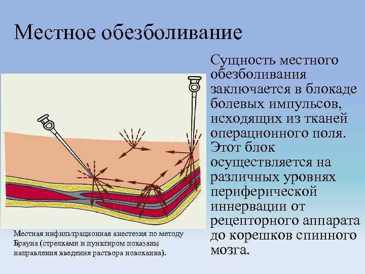 Анестезия по брауну