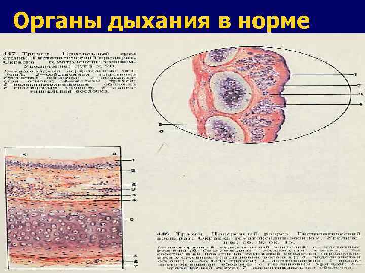 Органы дыхания в норме 