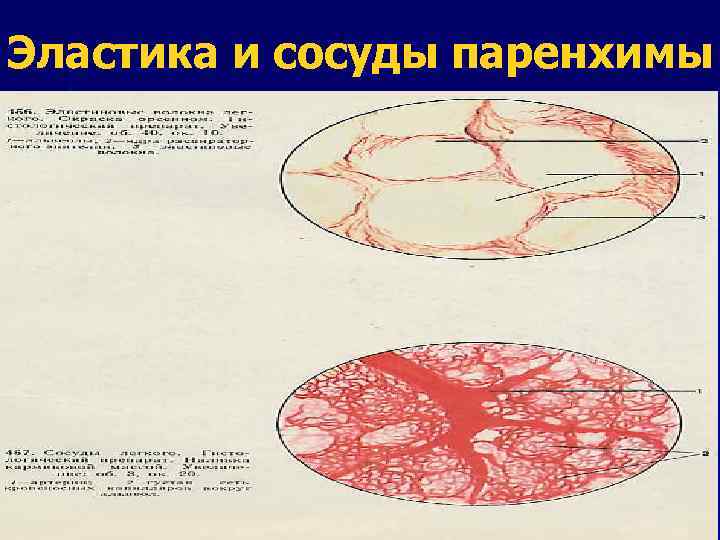 Эластика и сосуды паренхимы 