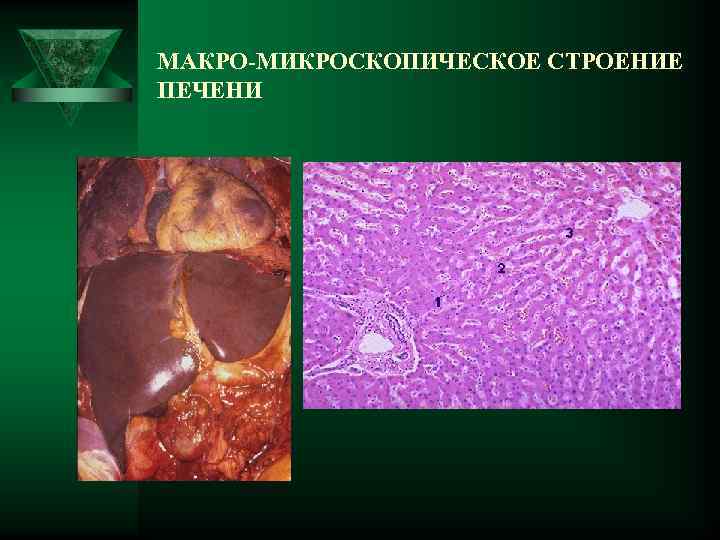 МАКРО-МИКРОСКОПИЧЕСКОЕ СТРОЕНИЕ ПЕЧЕНИ 