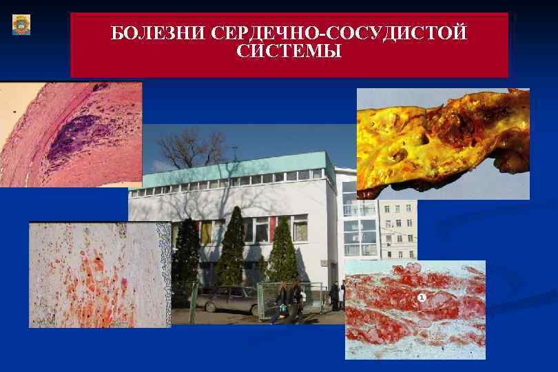 БОЛЕЗНИ СЕРДЕЧНО-СОСУДИСТОЙ СИСТЕМЫ 
