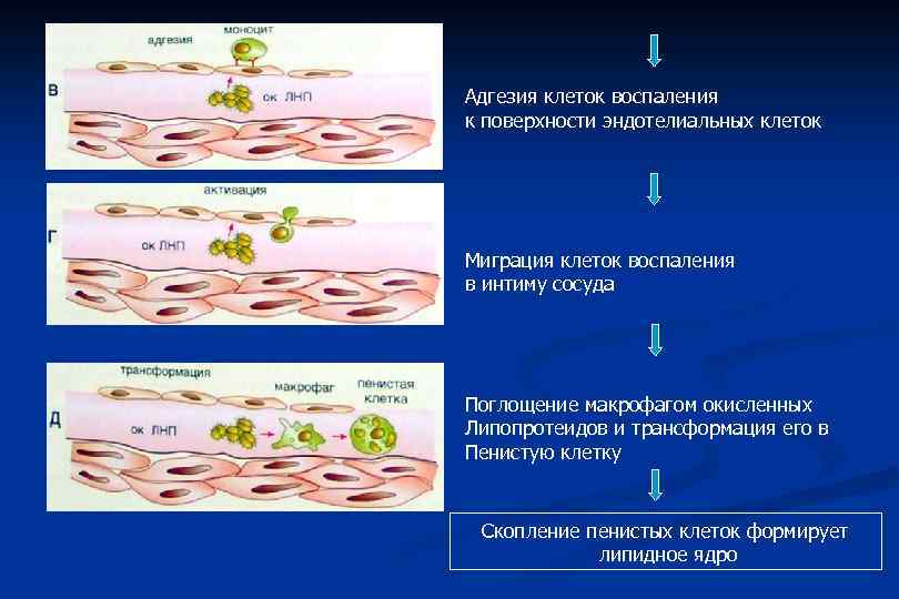 Адгезия клеток воспаления к поверхности эндотелиальных клеток Миграция клеток воспаления в интиму сосуда Поглощение