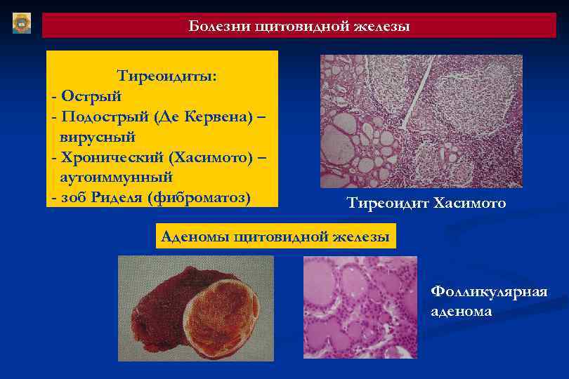 Эндокринные заболевания картинки